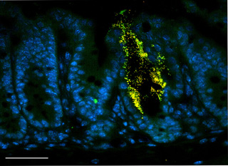 A micrograph of pathogenic bacteria (shown as yellow and green dots) attached to the lining of the intestine (shown as oval-shaped cells stained blue).