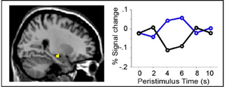 The hippocampus during conscious remembering of the past relative to memory based on stimulus familiarity.