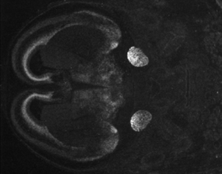 Visualization of the visual cortex in a developing brain.