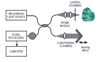 Optical Coherence Tomography.